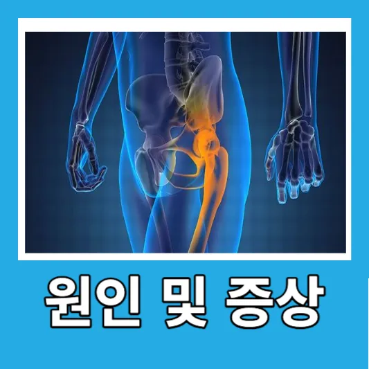 좌골 복숭아뼈 점액낭염의 원인 및 증상