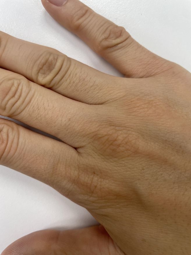 손등에 힘줄이 튀어나오는 이유