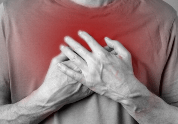 협심증 증상 - 가슴통증