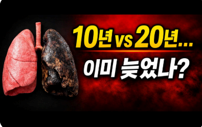 10년vs20년 이미 늦었나? 이미지사진