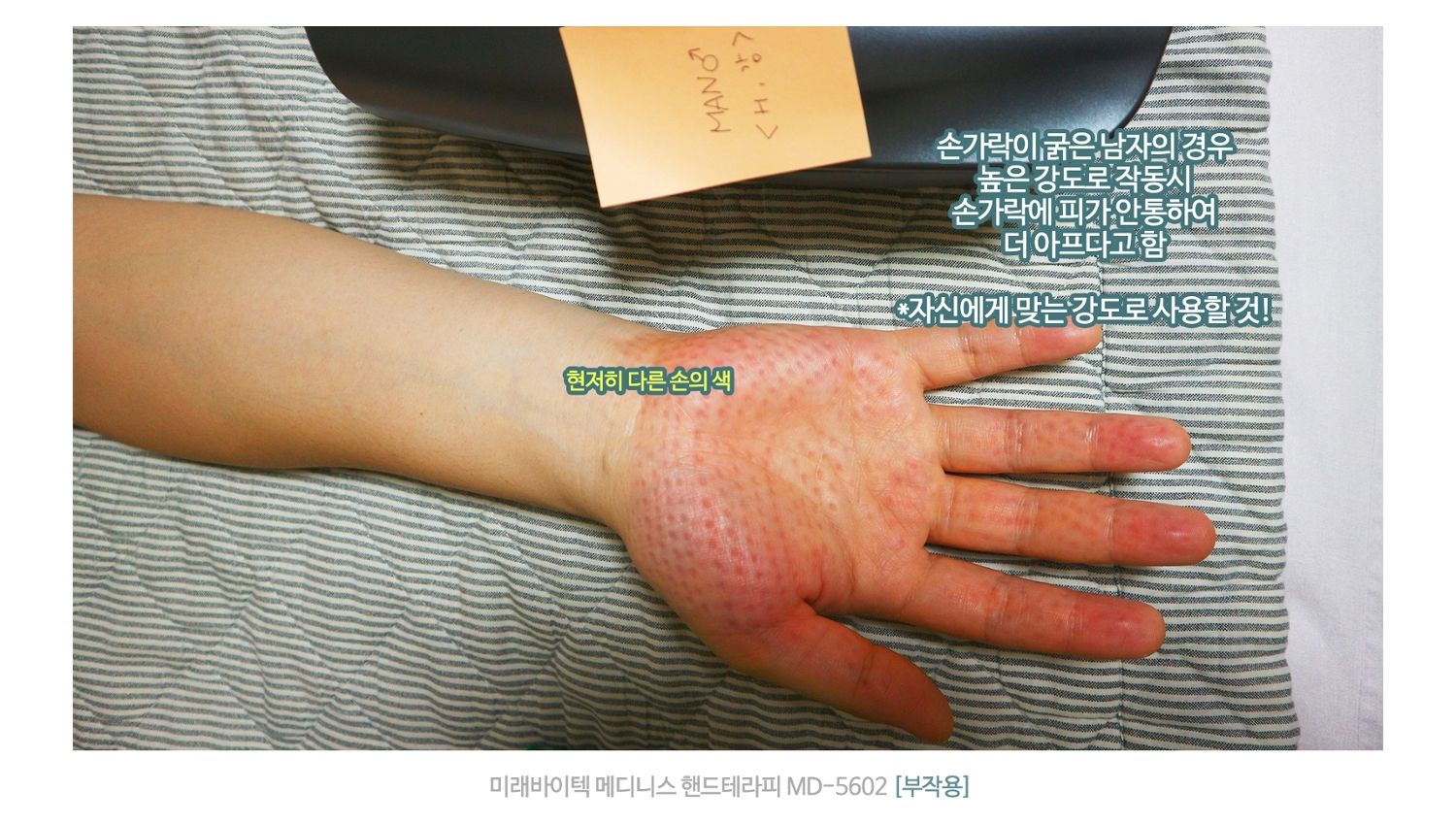 손 마사지기 후기 지압 자국 실사용