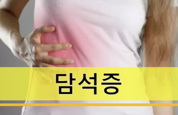 담석 통증, 이렇게 이겨냈어요