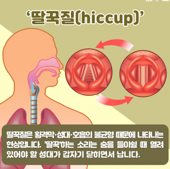 딸국질