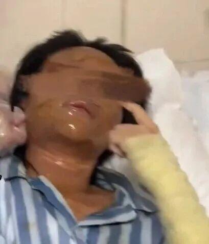 [충격 실화] “택배를 열자 폭탄이...” 여BJ 폭발물 테러 + 1000만 위안 당첨 후 아내 버린 남편의 두 얼굴