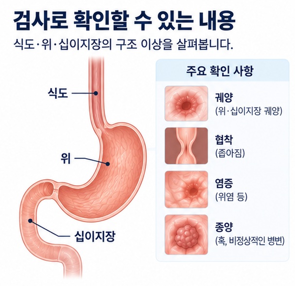 식도와 위, 십이지장에서 위장 조영검사로 확인하는 부위를 설명하는 이미지