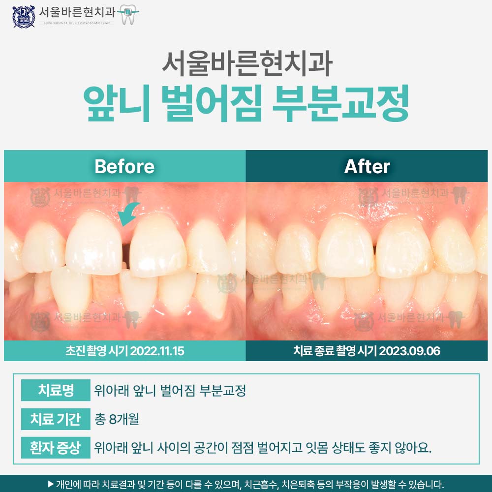 해운대교정치과