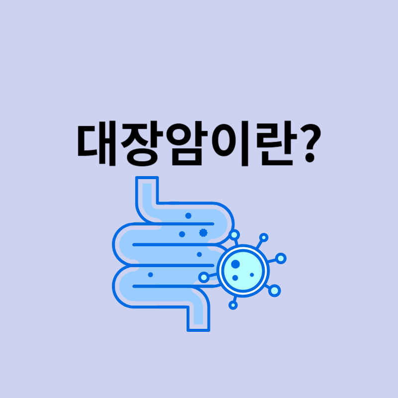 대장암