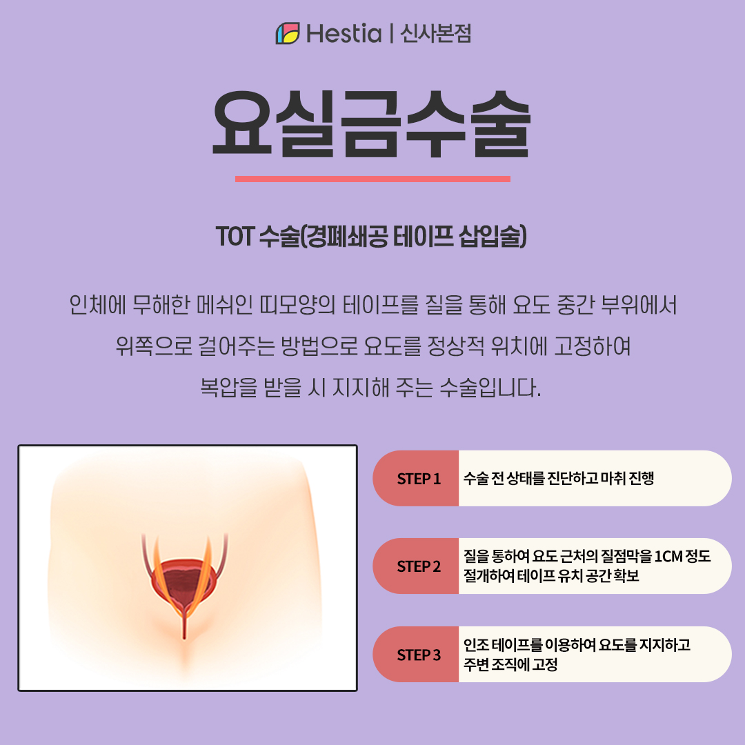 요실금수술이란?
