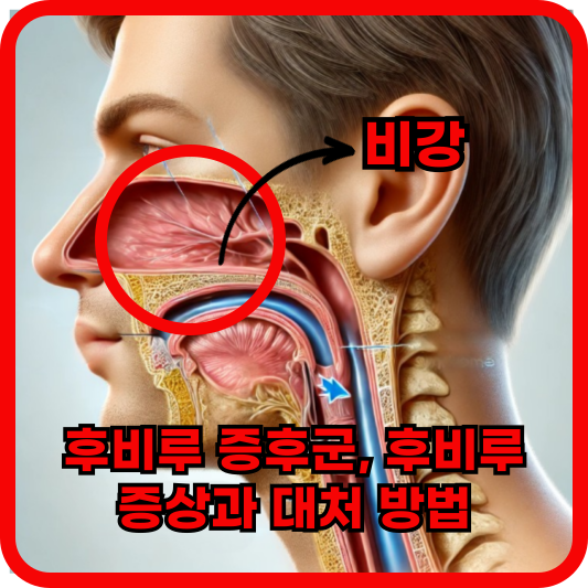 후비루 증후군