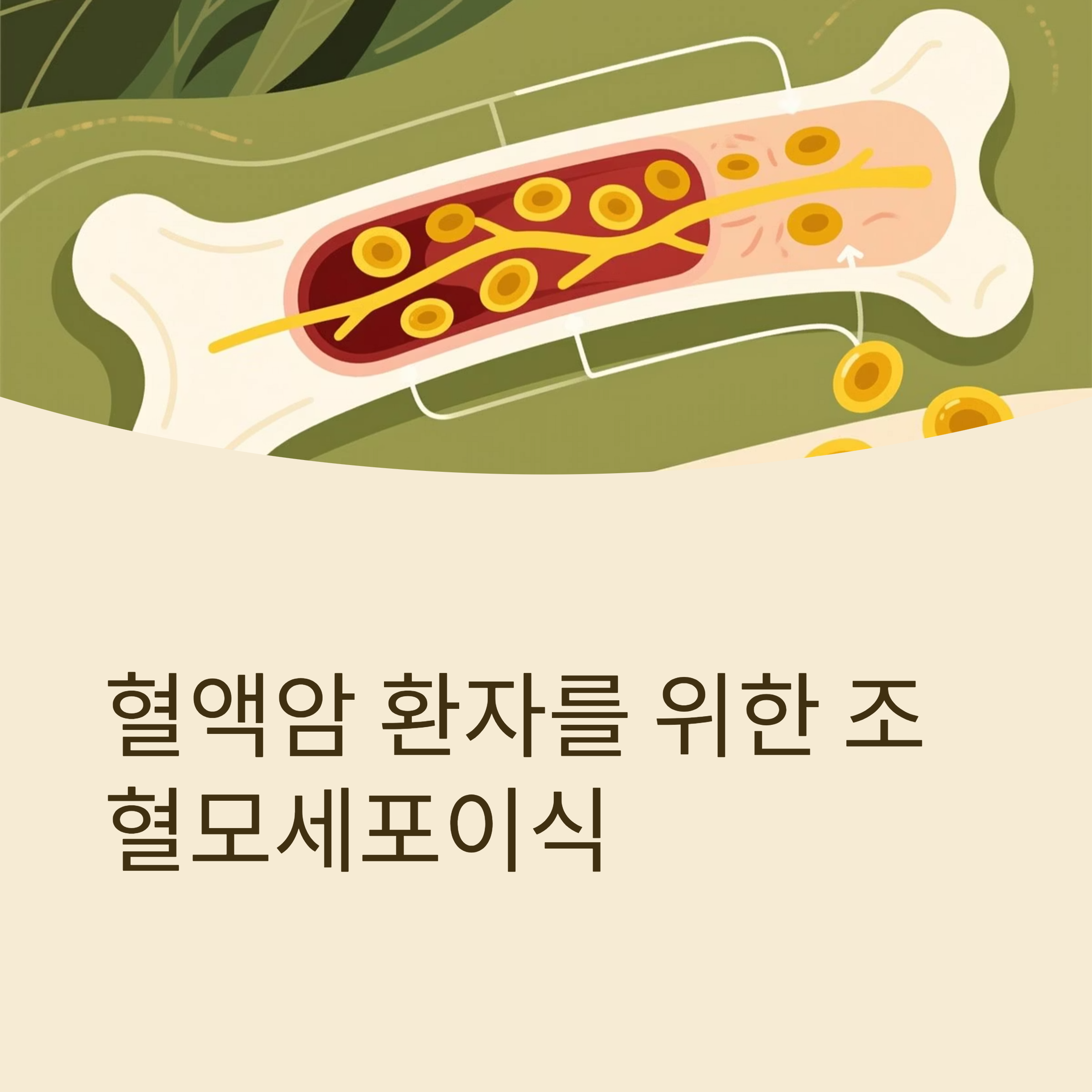 혈액암 조혈모세포이식 대표이미지