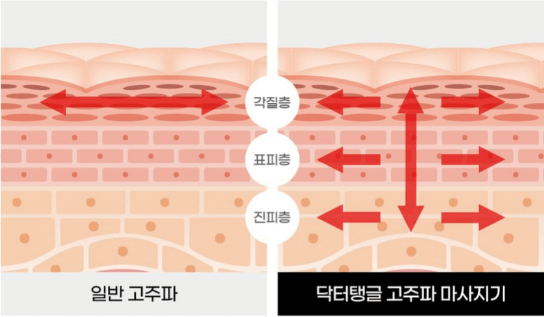 홈 뷰티 디바이스
