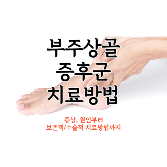 부주상골-증후군