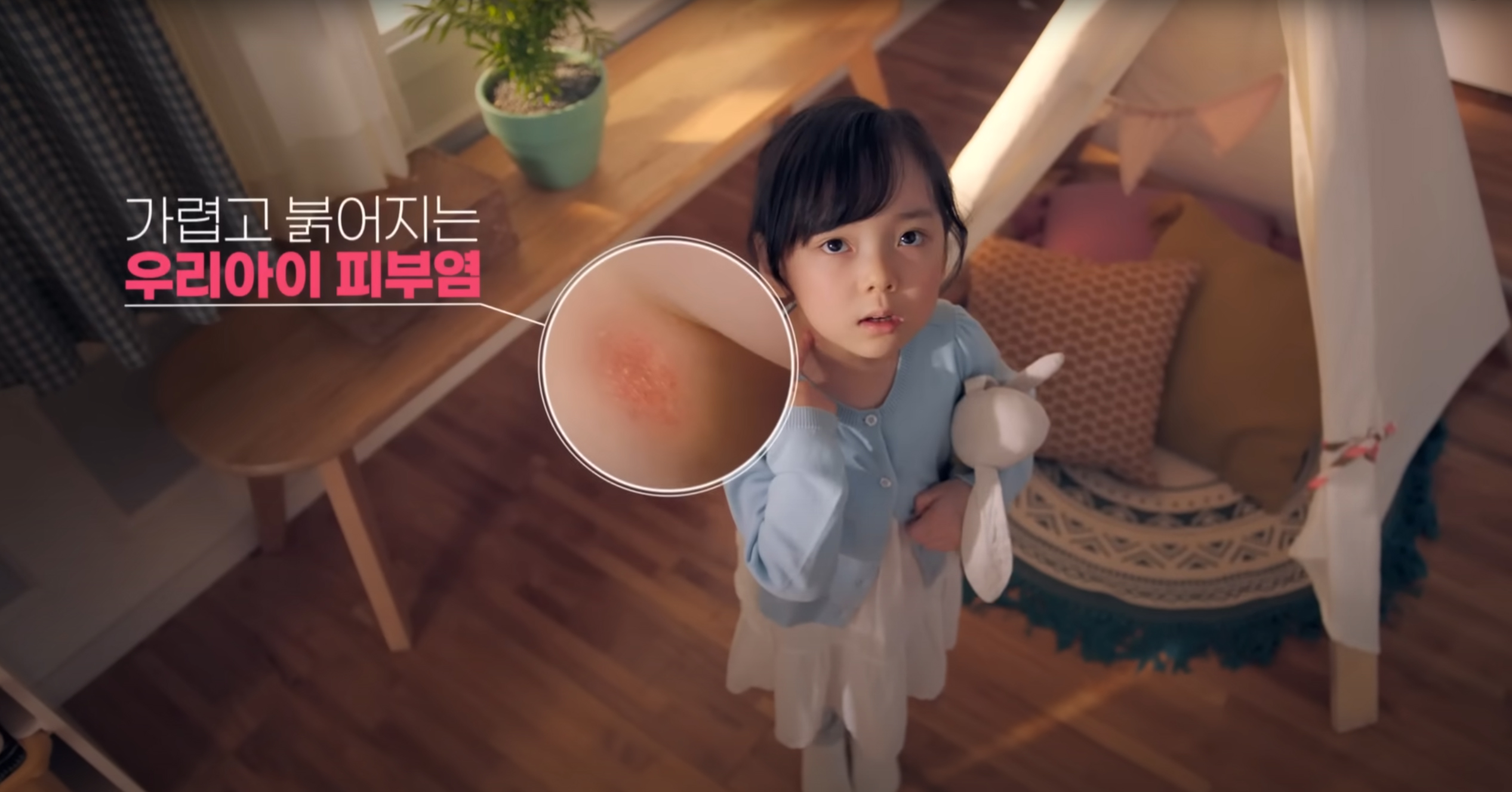 비판텐 연고
