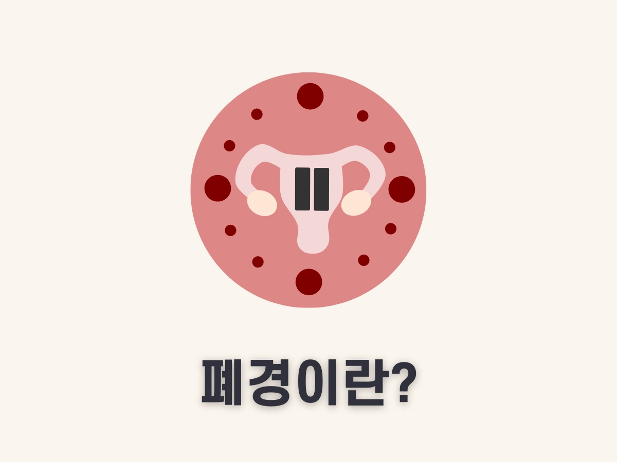 폐경