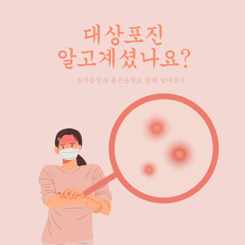 대상포진