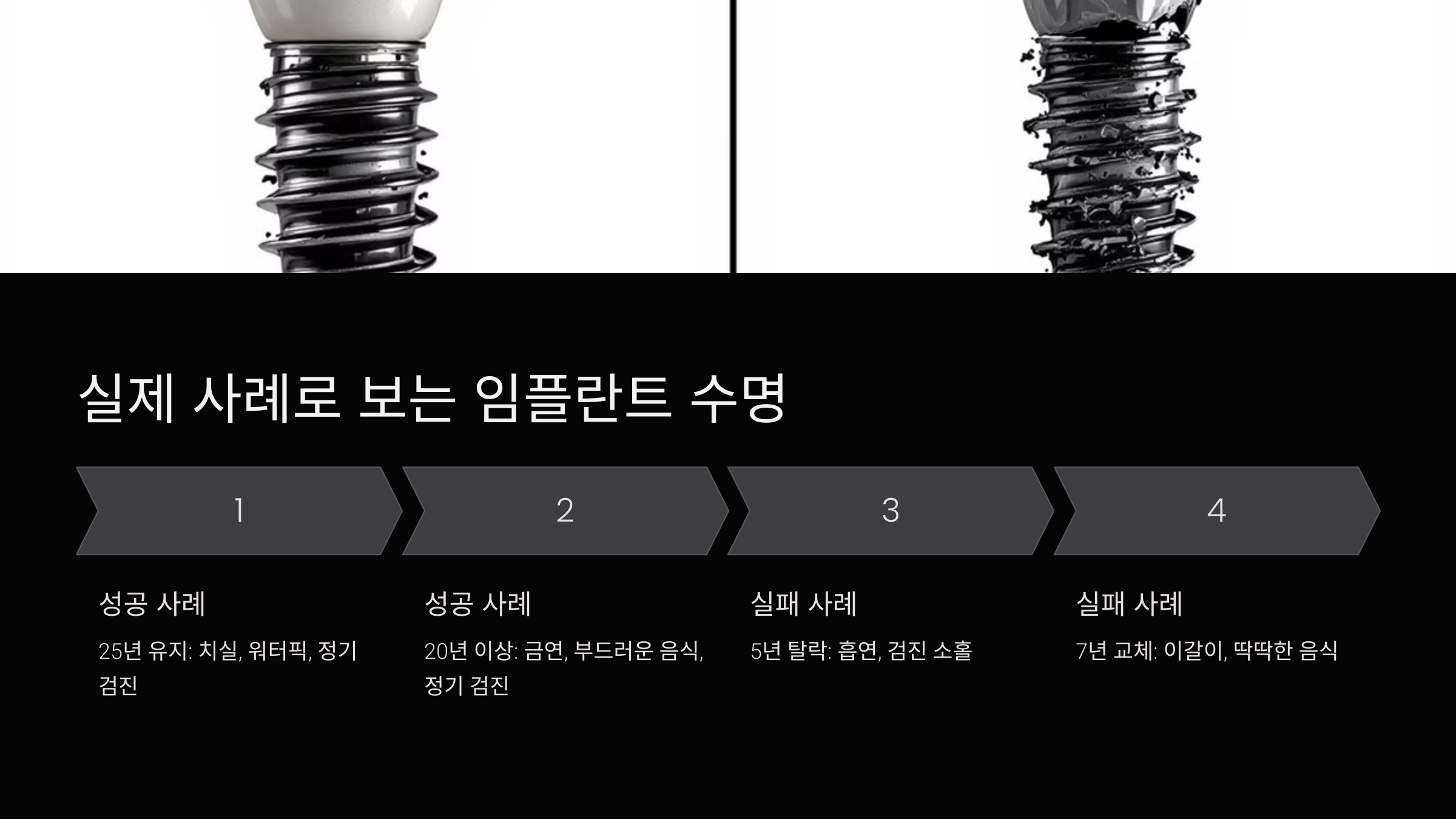 실제 사례로 보는 임플란트 수명