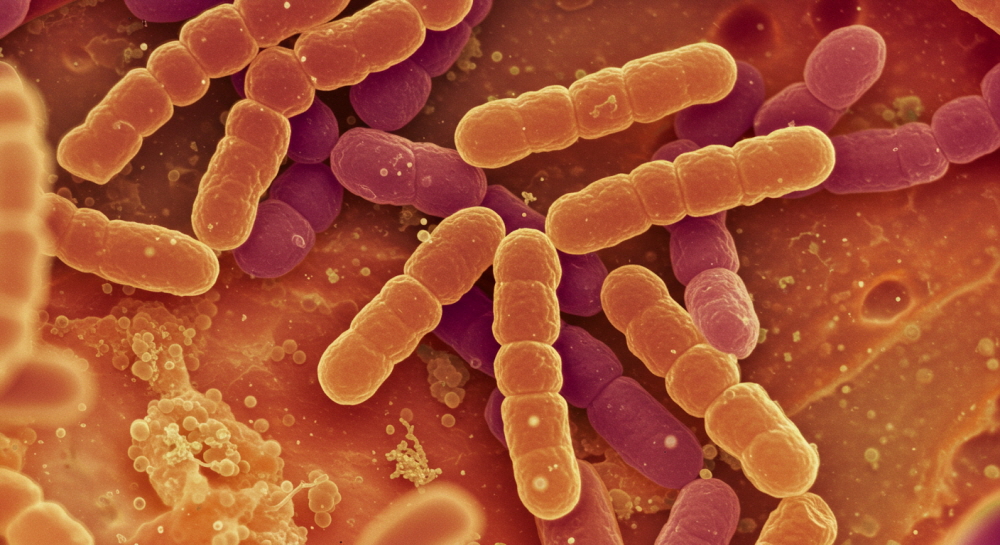 비엔날17 유산균 효능