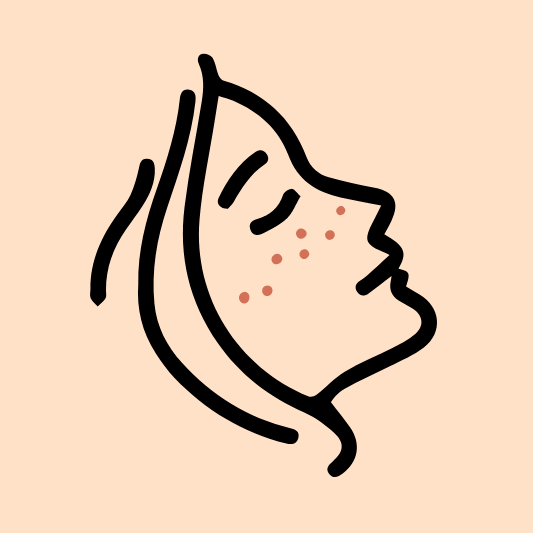 주근깨-이미지-예시