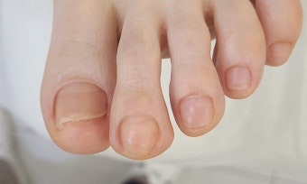 치료 성공을 위한 관리 원칙