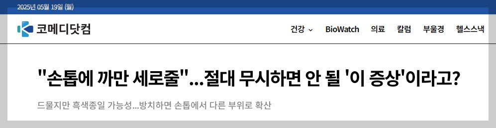 손톱 검은 세로줄