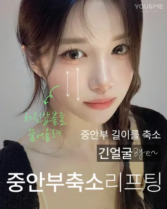 덴서티 리프팅 댄서티 가격 효과 유지기간에 관한 정보_22