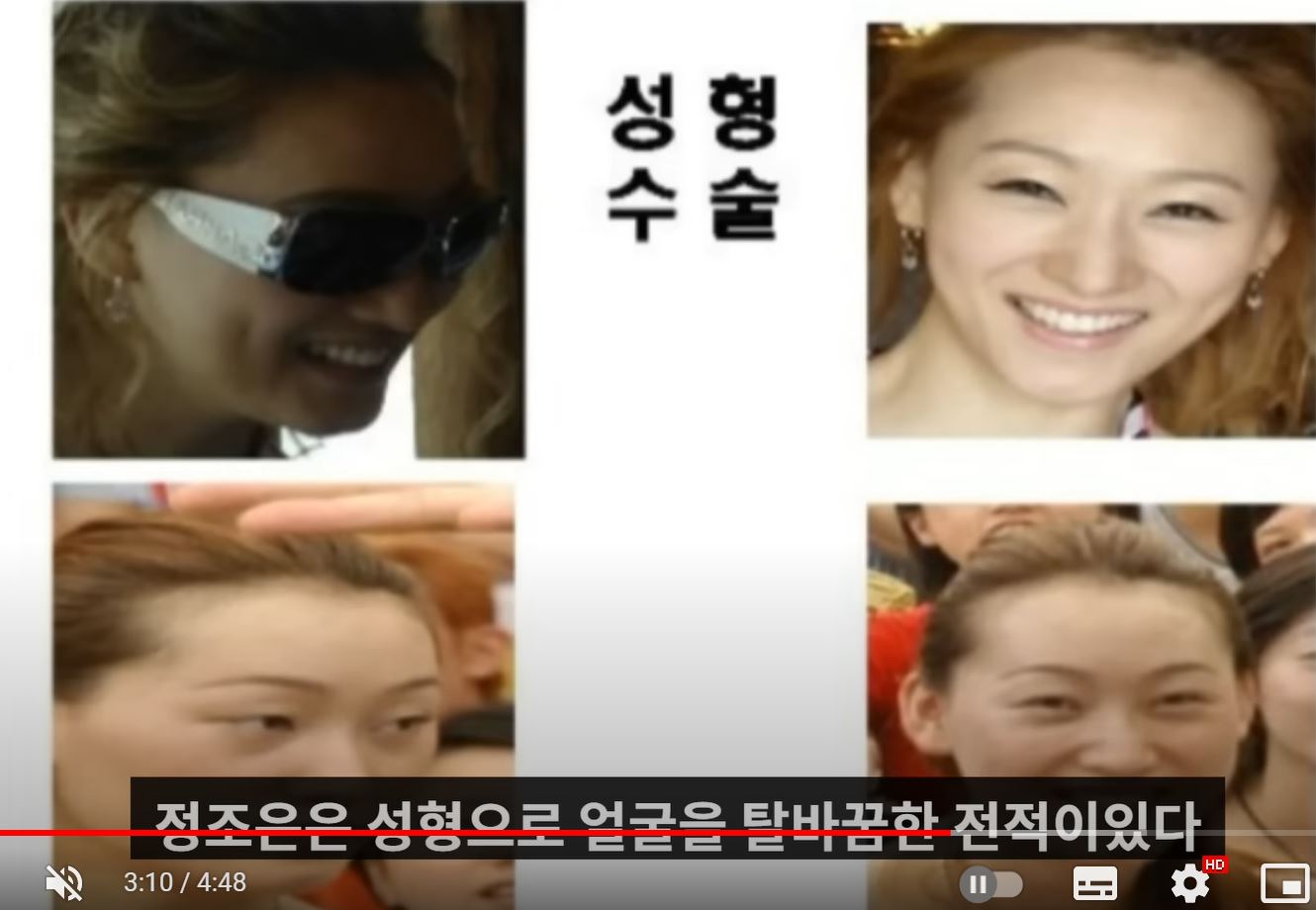 정조은 before after