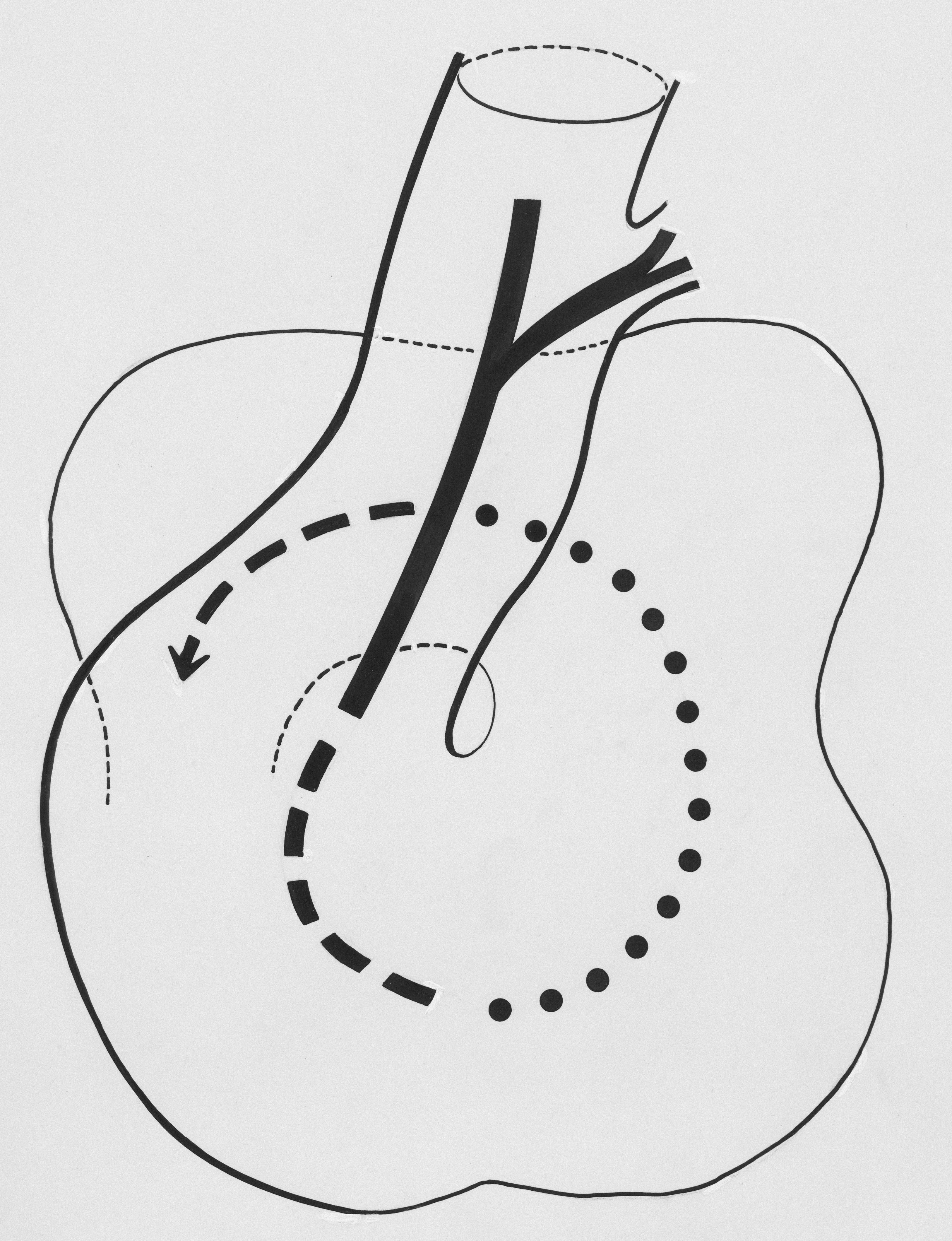 운동 후 몸관리법