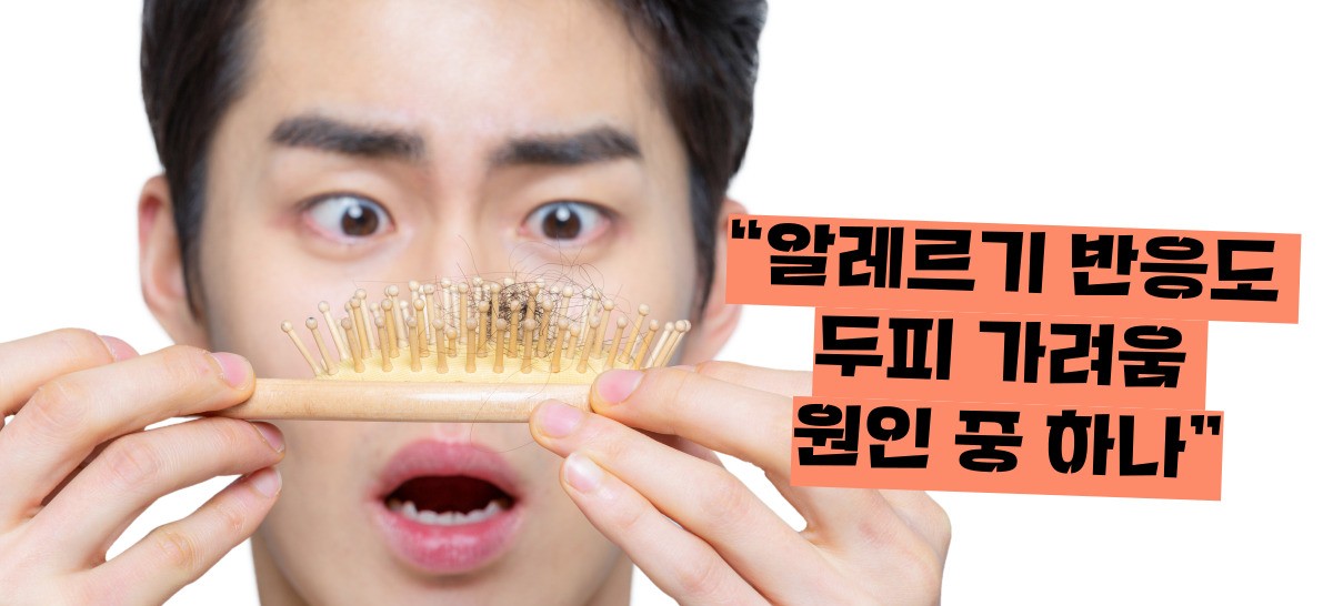 두피 가려움증 원인 치료