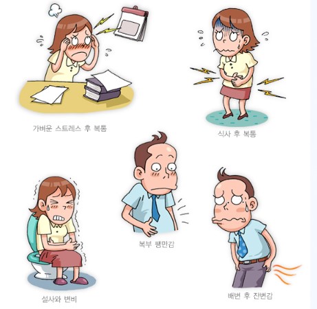 과민성 대장증후군