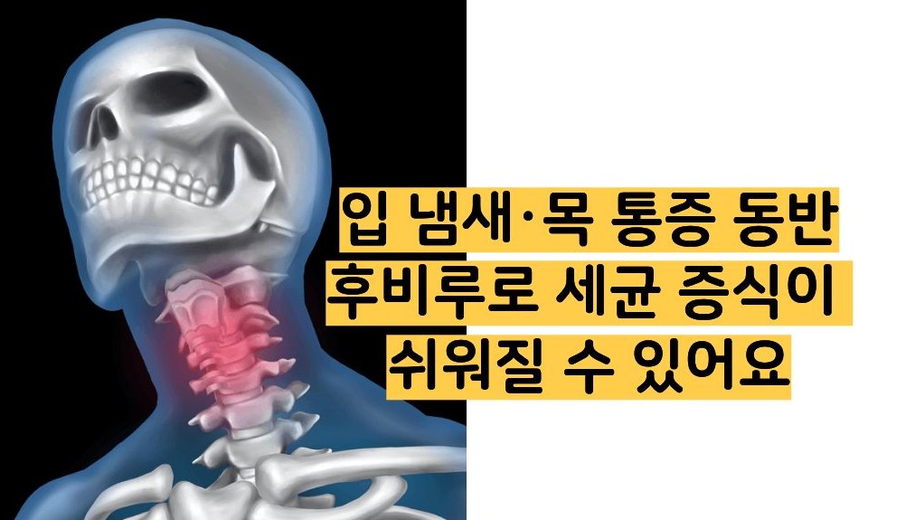 후비루 증상
