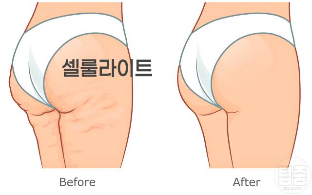 하체비만 탈출 다이어트 스쿼트