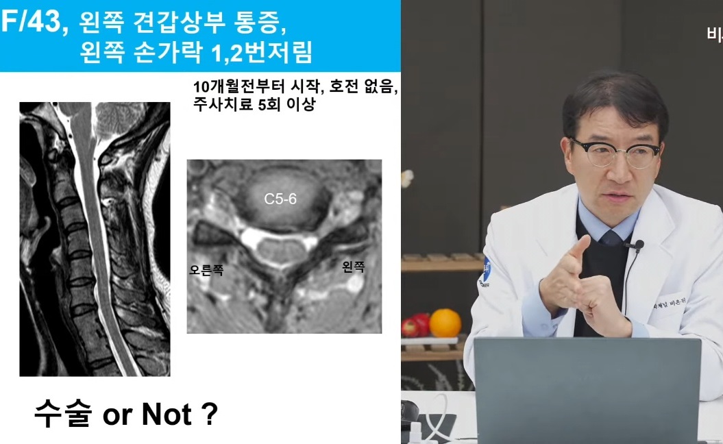 목디스크-경추증-강경중교수