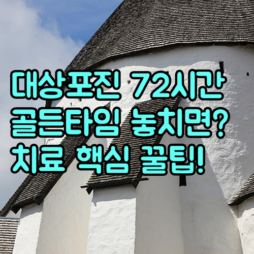 대상포진 치료 골든타임 72시간 의미..
