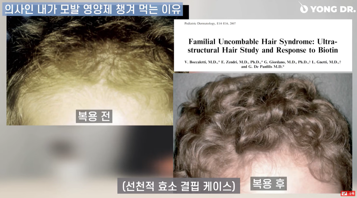 영양제 먹기 전 후 비교