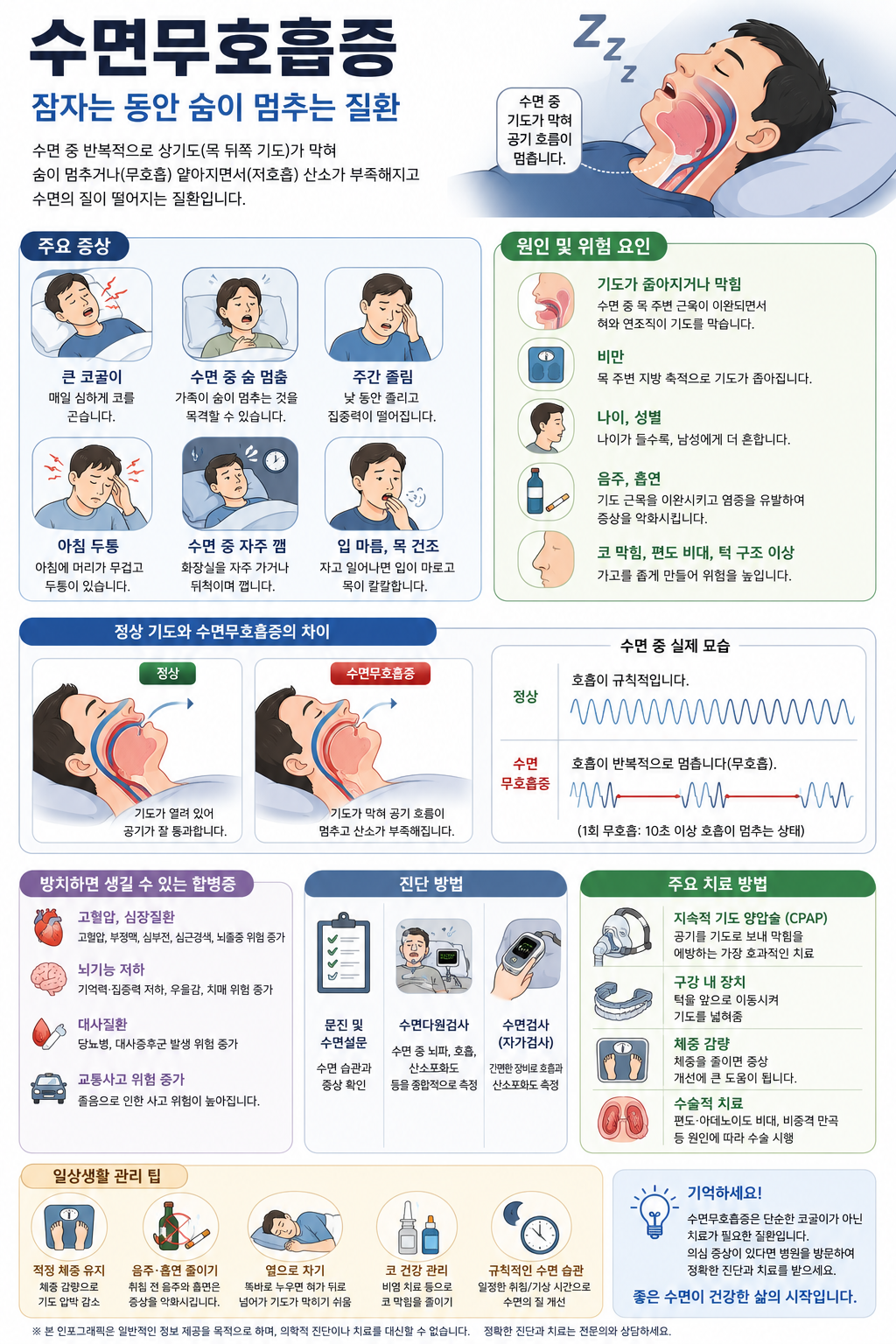 수면 무호흡증