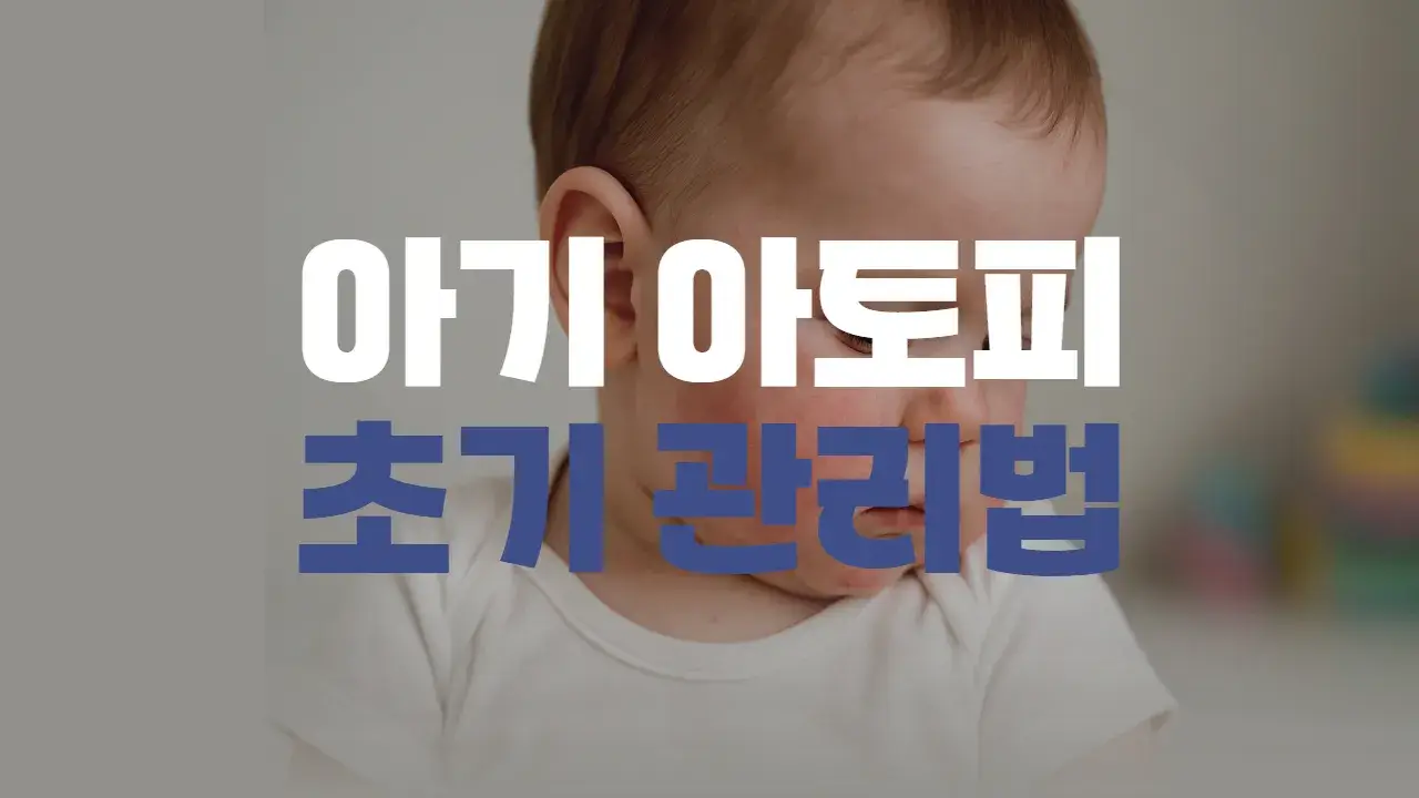 아기 아토피 초기 관리법