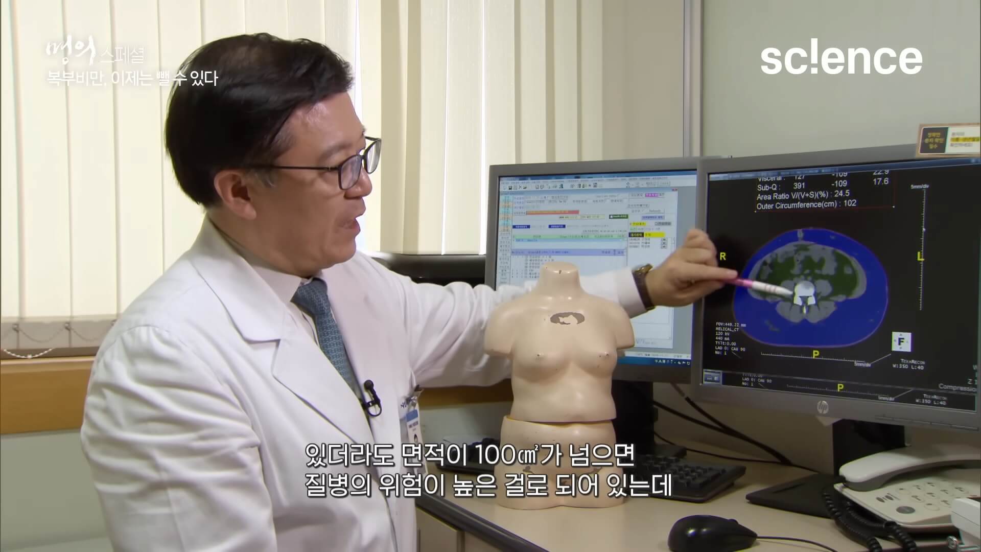 복부 지방에 대한 컴퓨터 이미지를 설명하는 명의