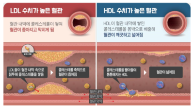 콜레스테롤 이미지