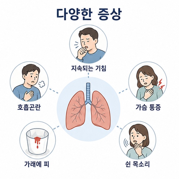 지속되는 기침, 숨참, 가슴 통증, 가래에 피가 섞이는 증상과 쉰 목소리 등 폐암에서 나타날 수 있는 변화를 정리한 그림