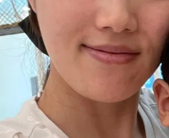 생리 전 뾰루지 폭발 원인과 해결법 7가지 생리 전후 뾰루지 발생 이유 완벽 분석_19
