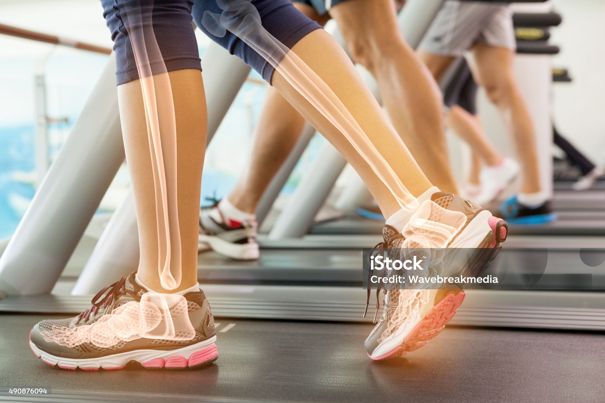 골다공증 완화에 도움 되는 음식 트렌드