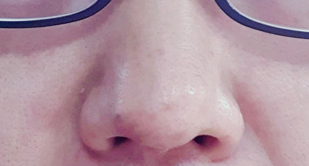 전방에서-본-코