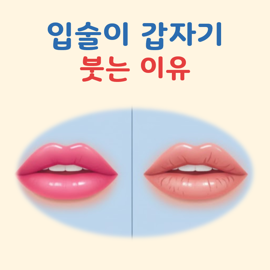 입술이 갑자기 붓는 이유 대표 이미지