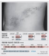 대상포진 초기증상