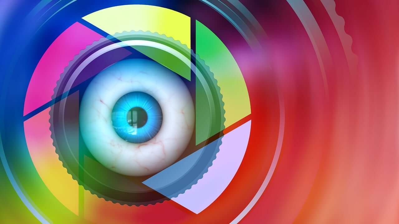 고도근시성 황반변성 관련 사진자료 2