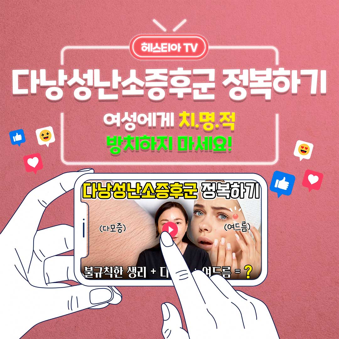 다낭성 난소 증후군