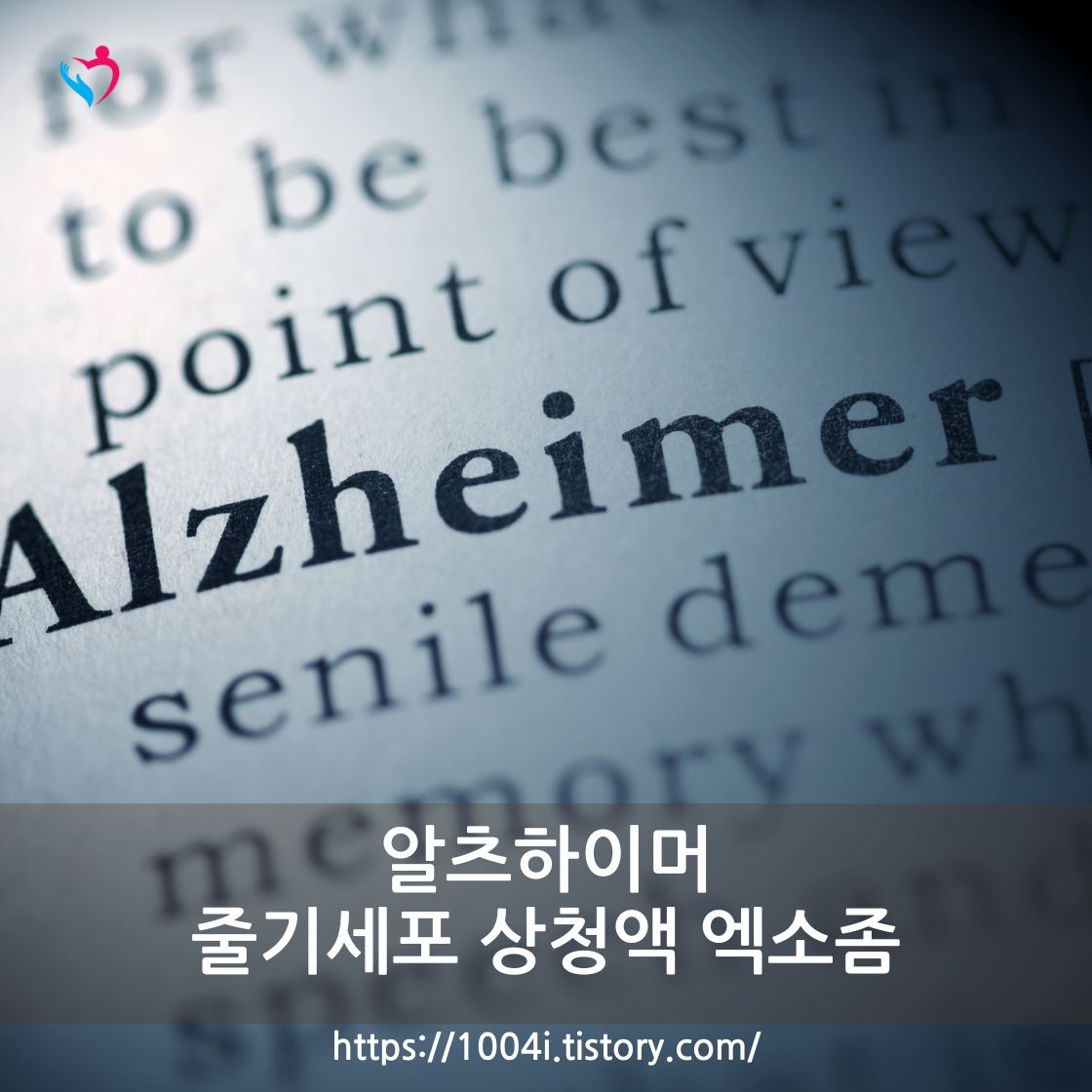 알츠하이머성 치매 뇌 신경 질환