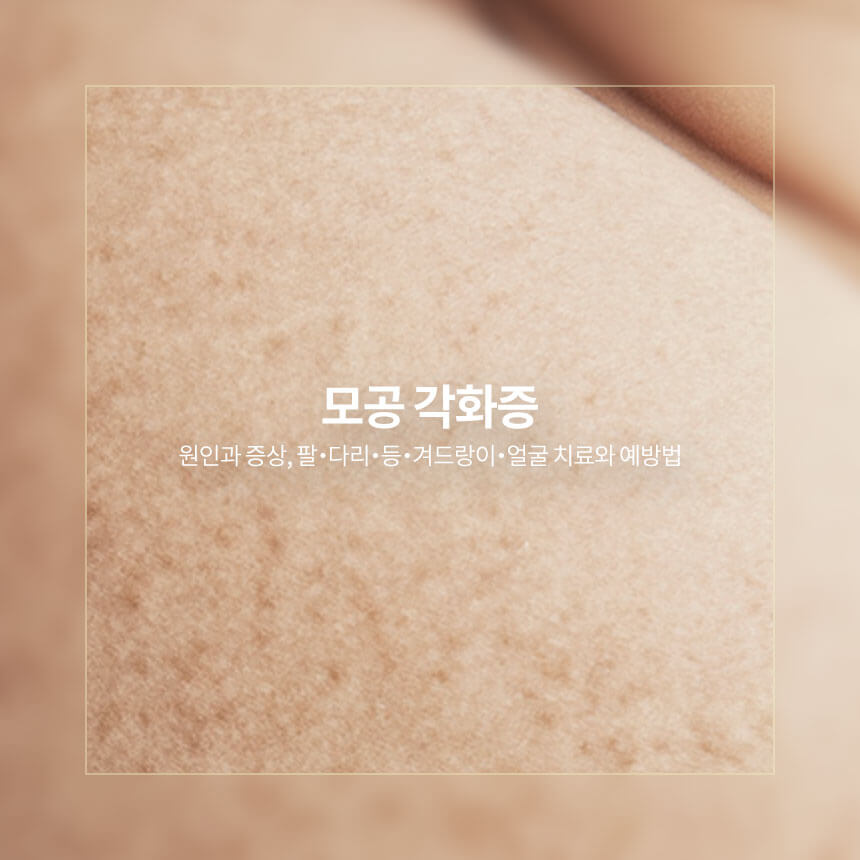 “모공-각화증-원인과-증상-치료와-예방법”