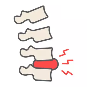 허리디스크에 좋은 운동