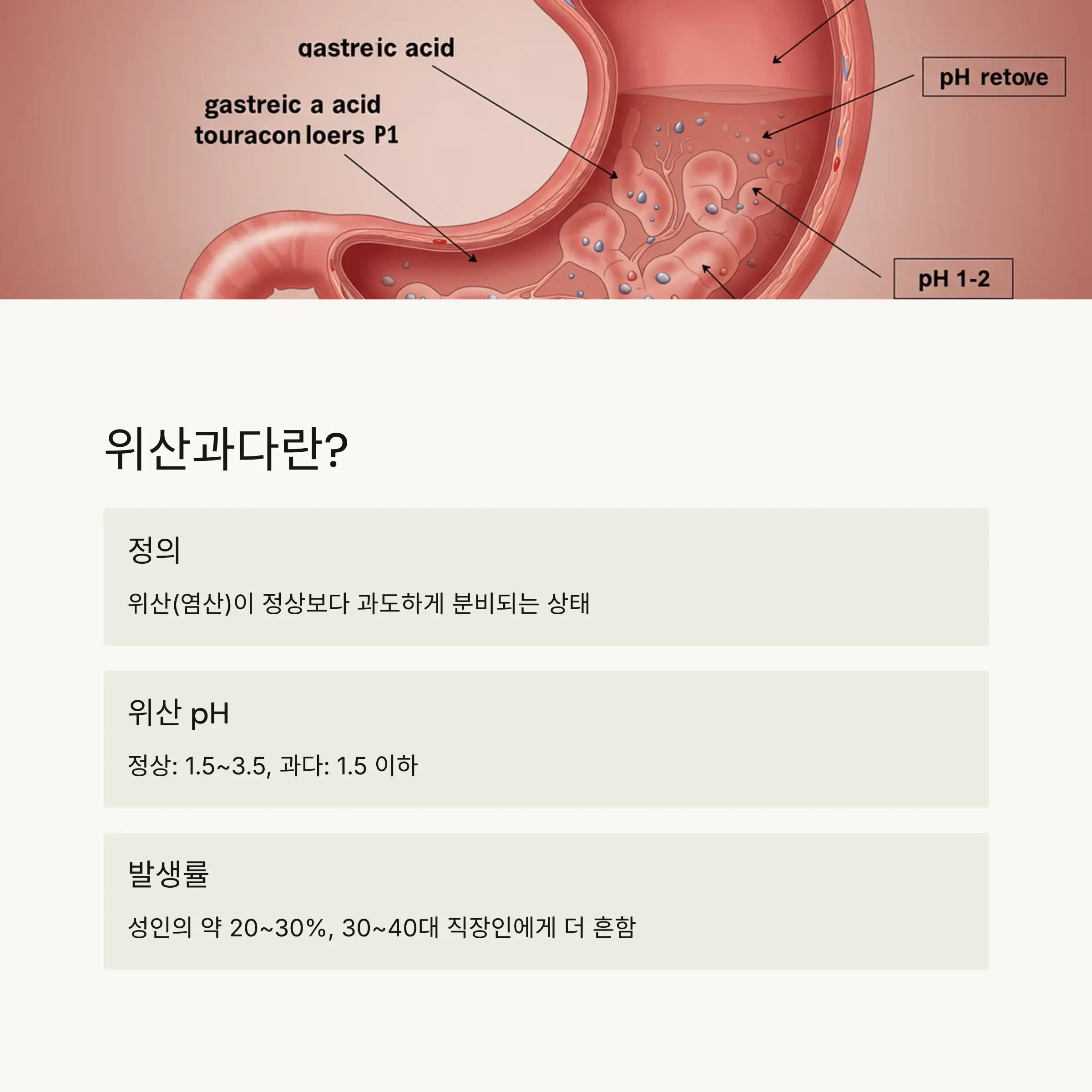 🔍 위산과다의 정의와 특징